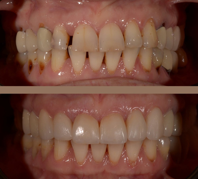 Slider image (1) UltimaDent